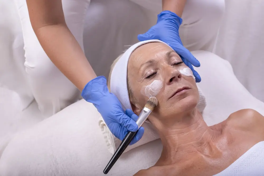 Peeling químico ou laser