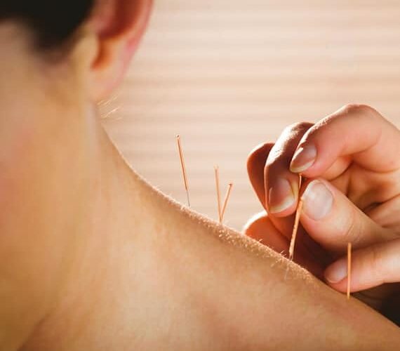 recebendo tratamento de terapia de acupuntura