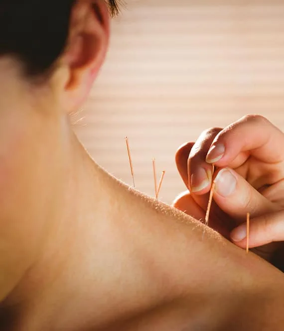 Os benefícios da acupuntura à medida que envelhece