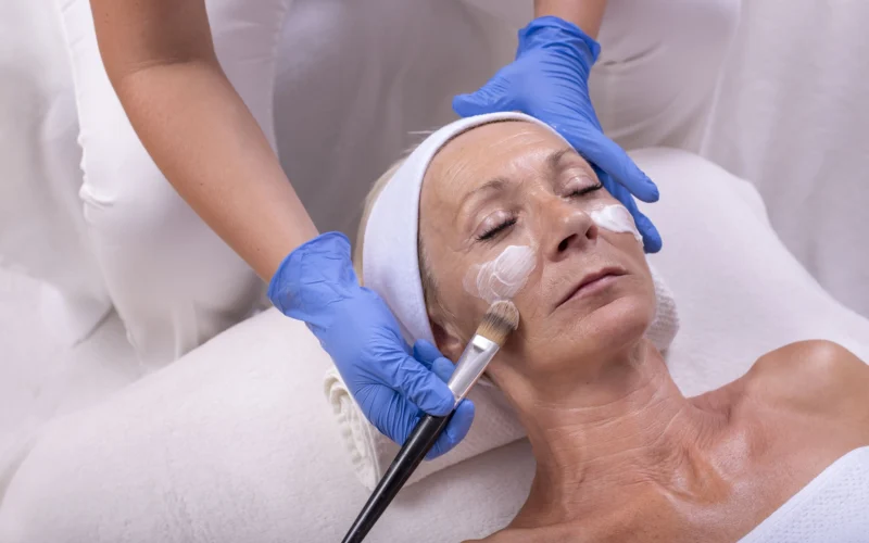 Peeling químico ou laser